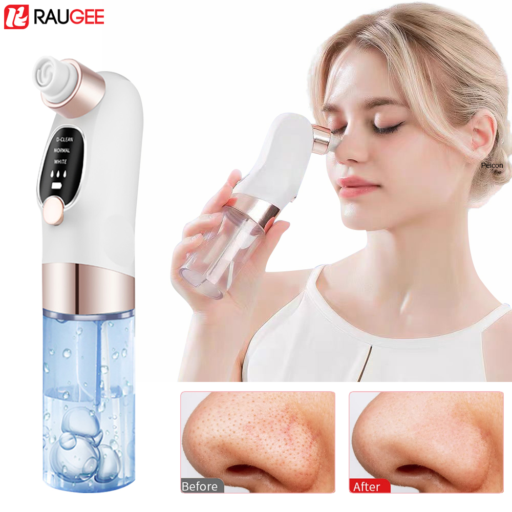 Blackhead Remover Electric Bla - Air Bubble Remover 评论和价格